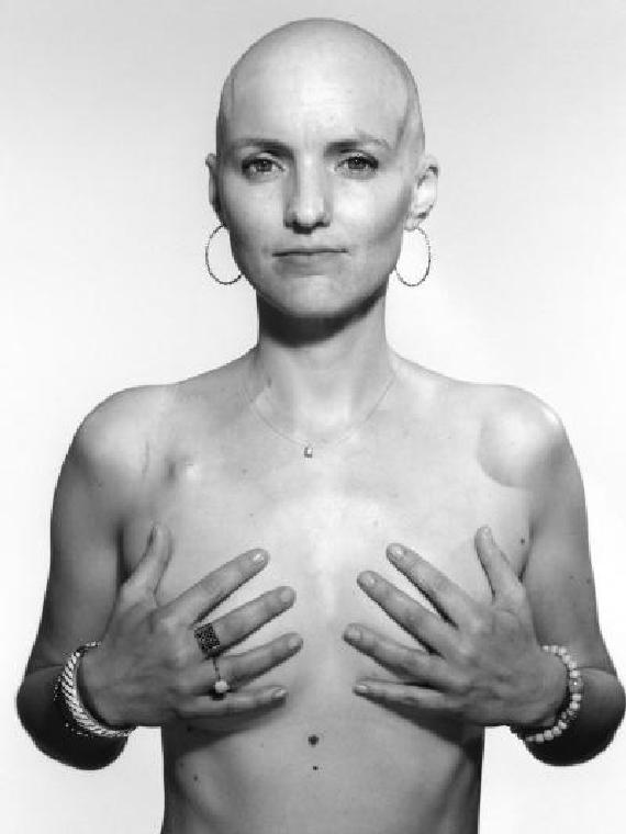 Exposition Des femmes dans la tourmente - Portraits de femmes face au cancer 